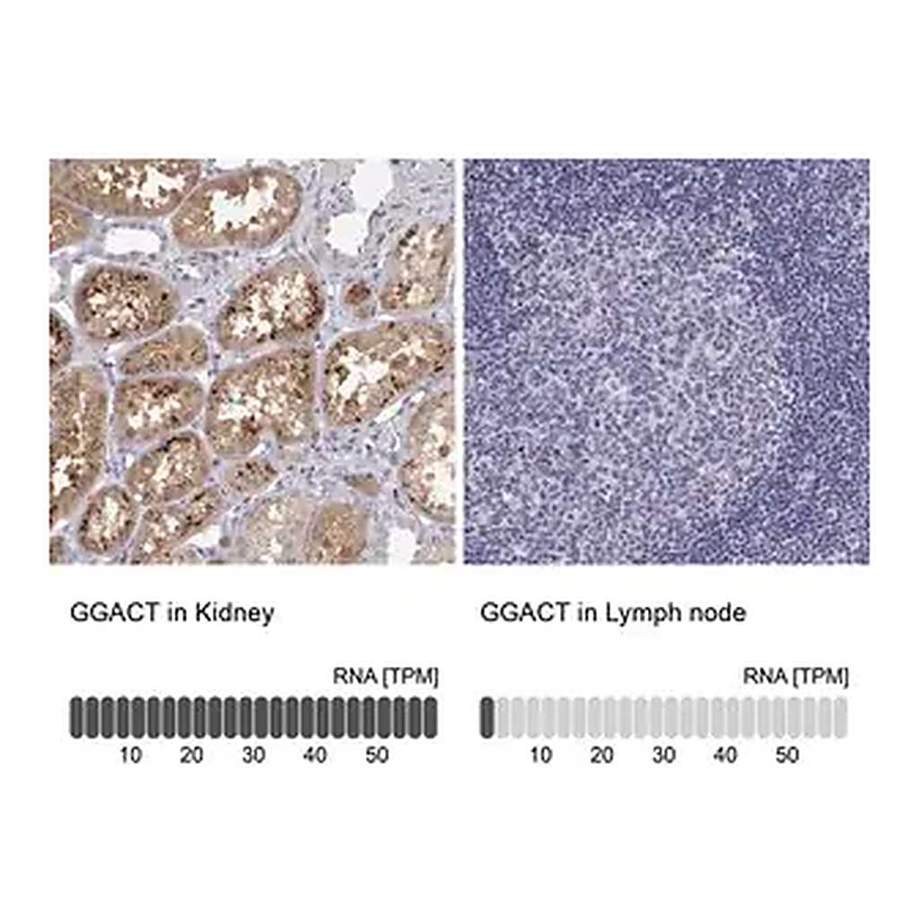 Merck Anti-GGACT antibody produced in rabbit