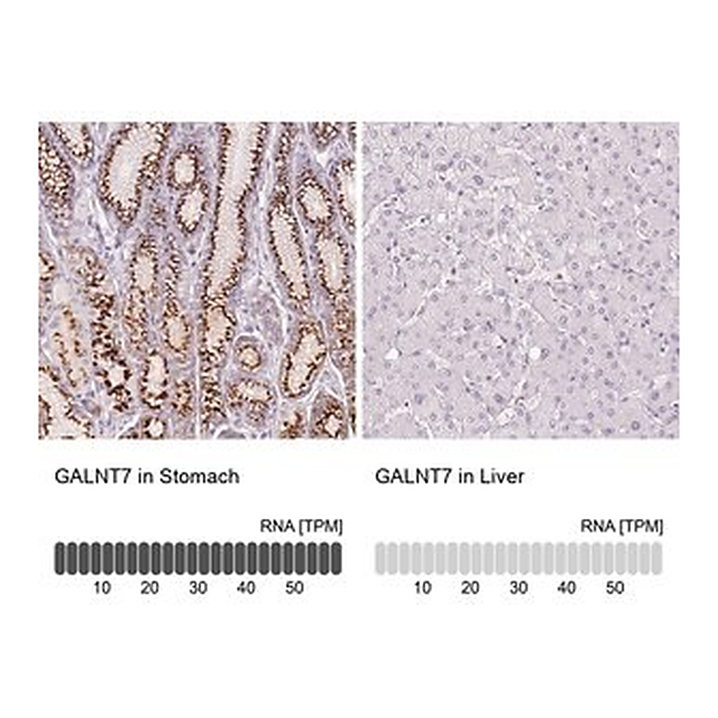 Merck Anti-GALNT7 antibody produced in rabbit