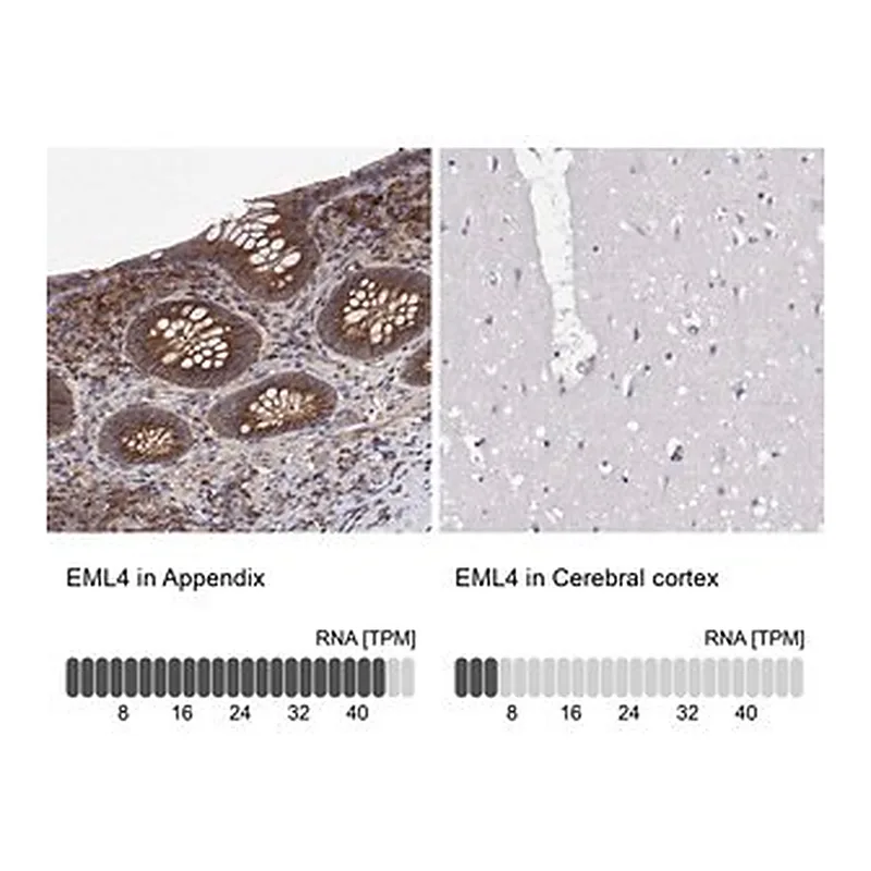 Merck Anti-EML4 antibody produced in rabbit