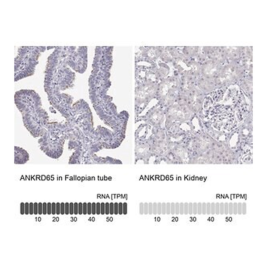 Merck Anti-ANKRD65 antibody produced in rabbit