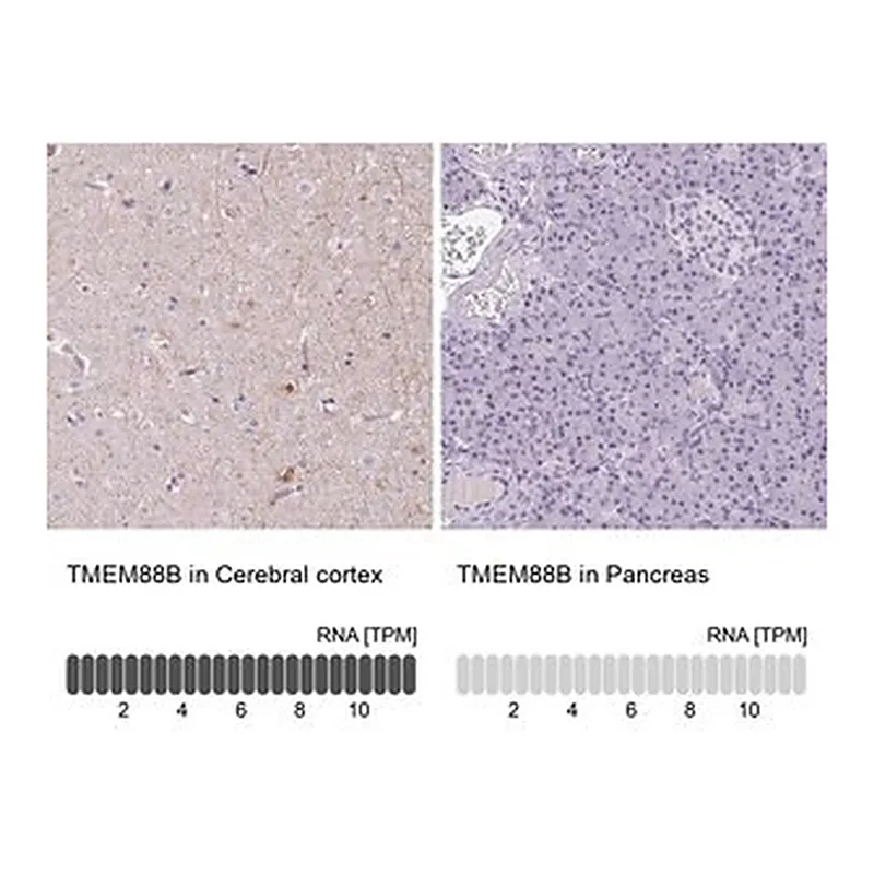 Merck Anti-TMEM88B antibody produced in rabbit