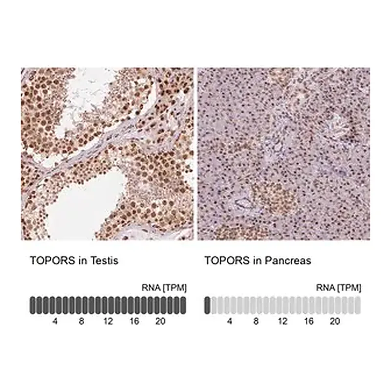 Merck Anti-TOPORS antibody produced in rabbit