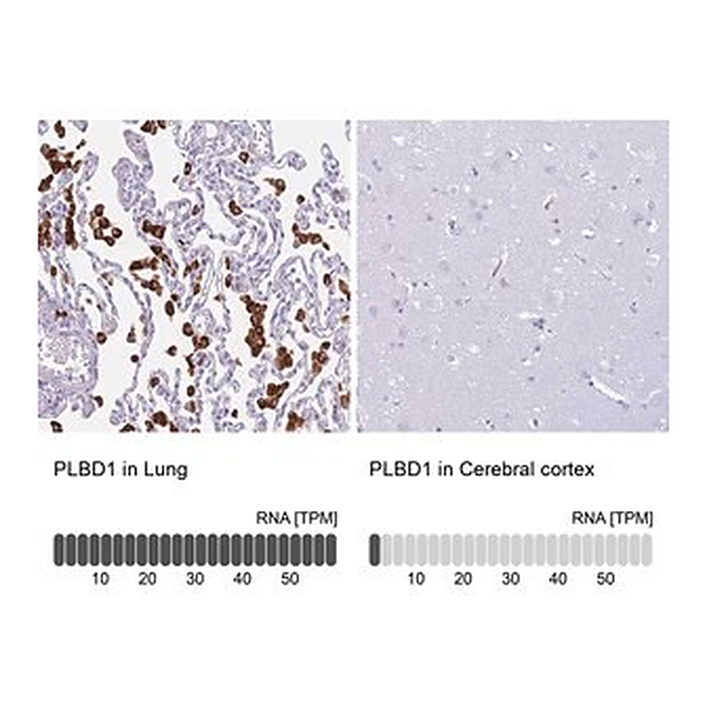 Merck Anti-PLBD1 antibody produced in rabbit