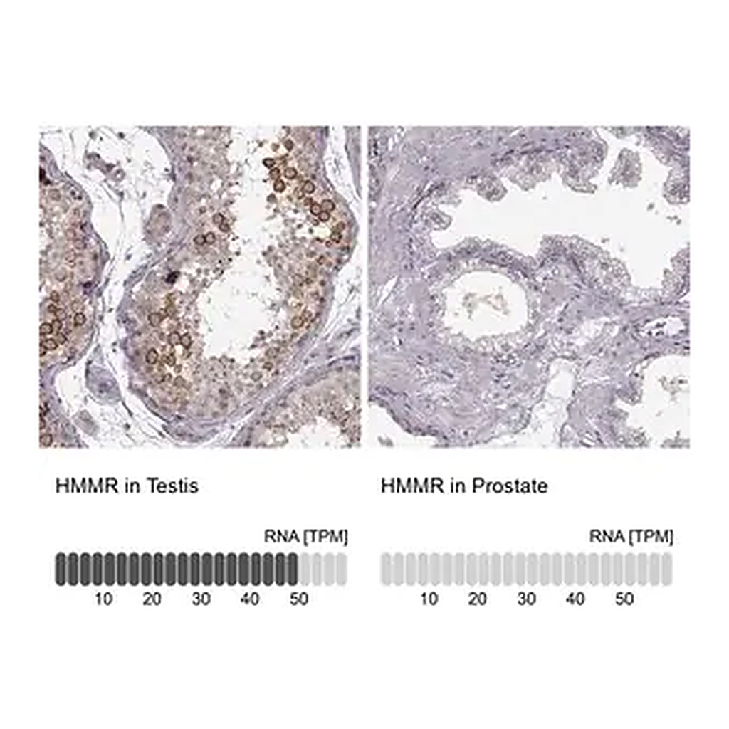 Merck Anti-HMMR antibody produced in rabbit