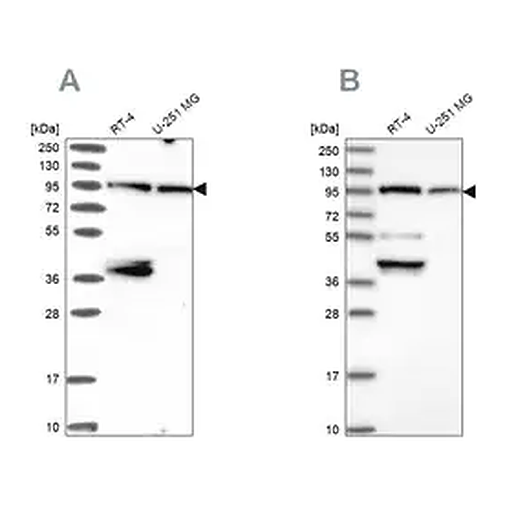Merck Anti-UBE3A antibody produced in rabbit