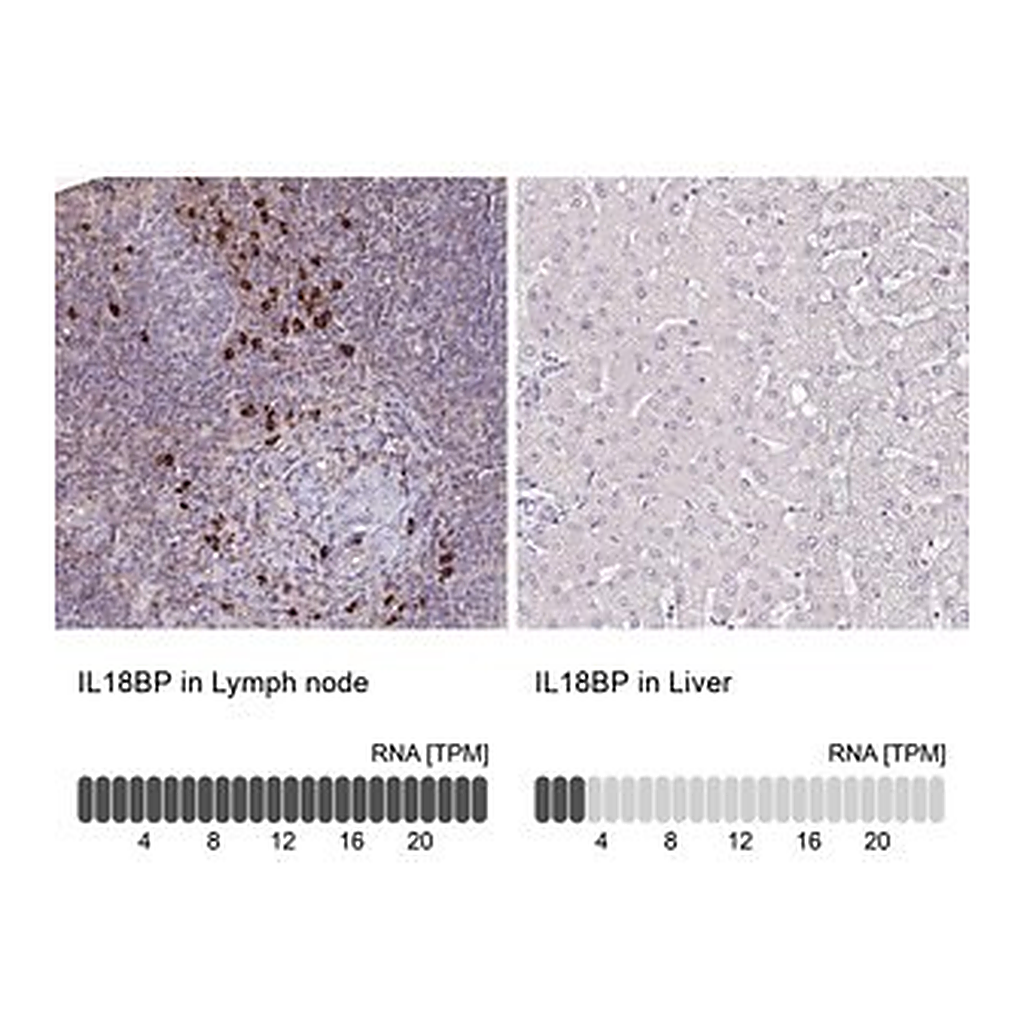 Merck Anti-IL18BP antibody produced in rabbit