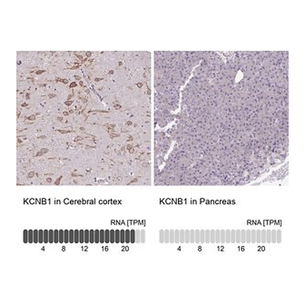 Merck Anti-KCNB1 antibody produced in rabbit