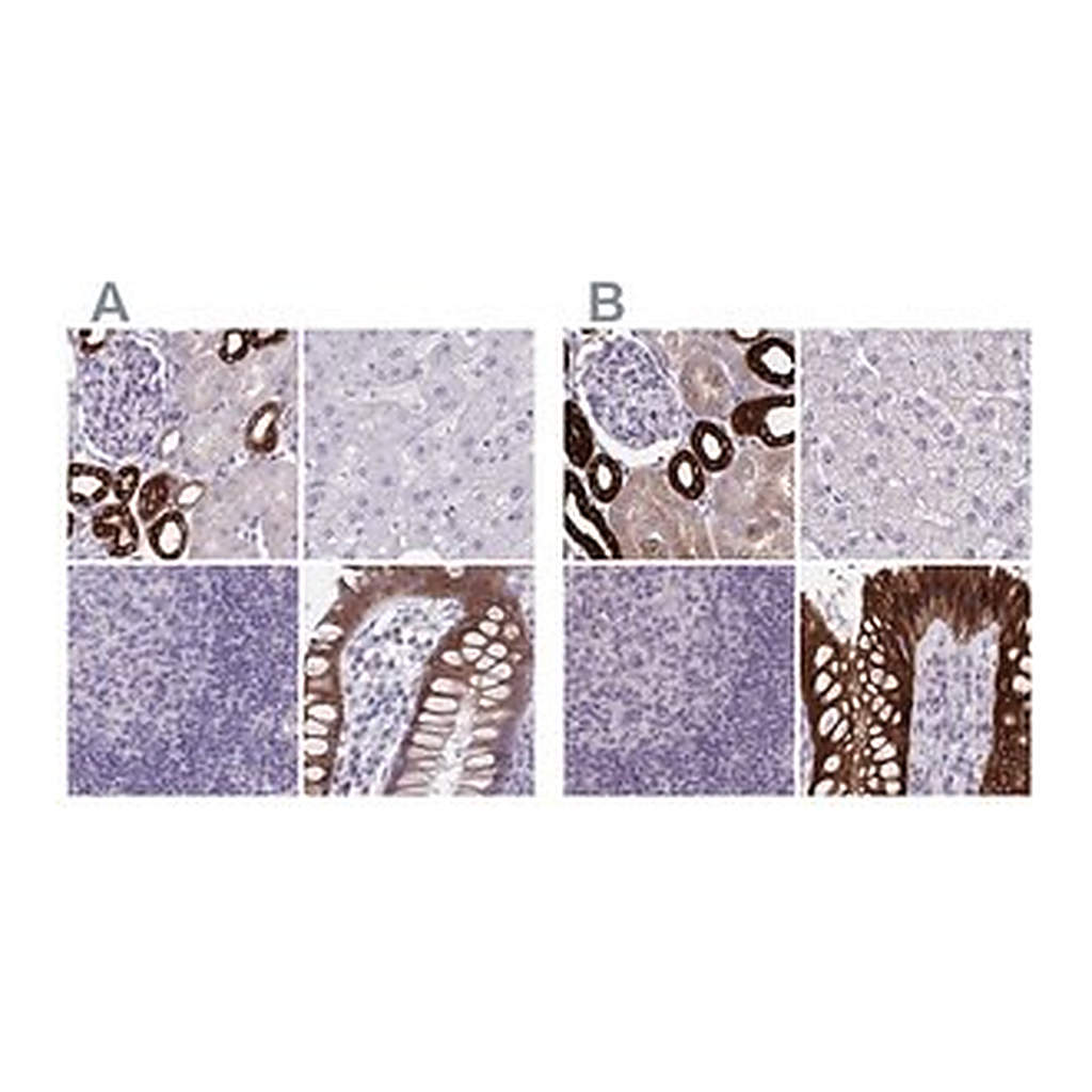 Merck Anti-HSD11B2 antibody produced in rabbit