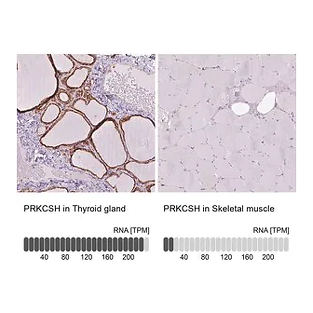 Merck Anti-PRKCSH antibody produced in rabbit