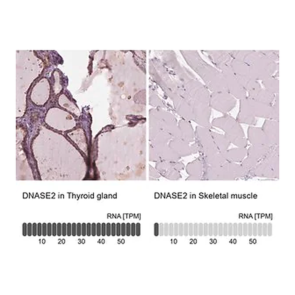 Merck Anti-DNASE2 antibody produced in rabbit