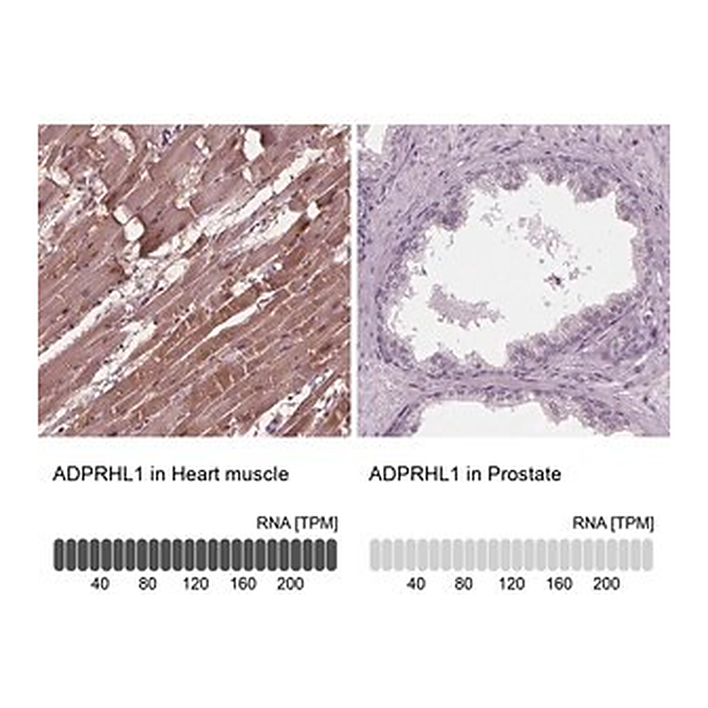 Merck Anti-ADPRHL1 antibody produced in rabbit