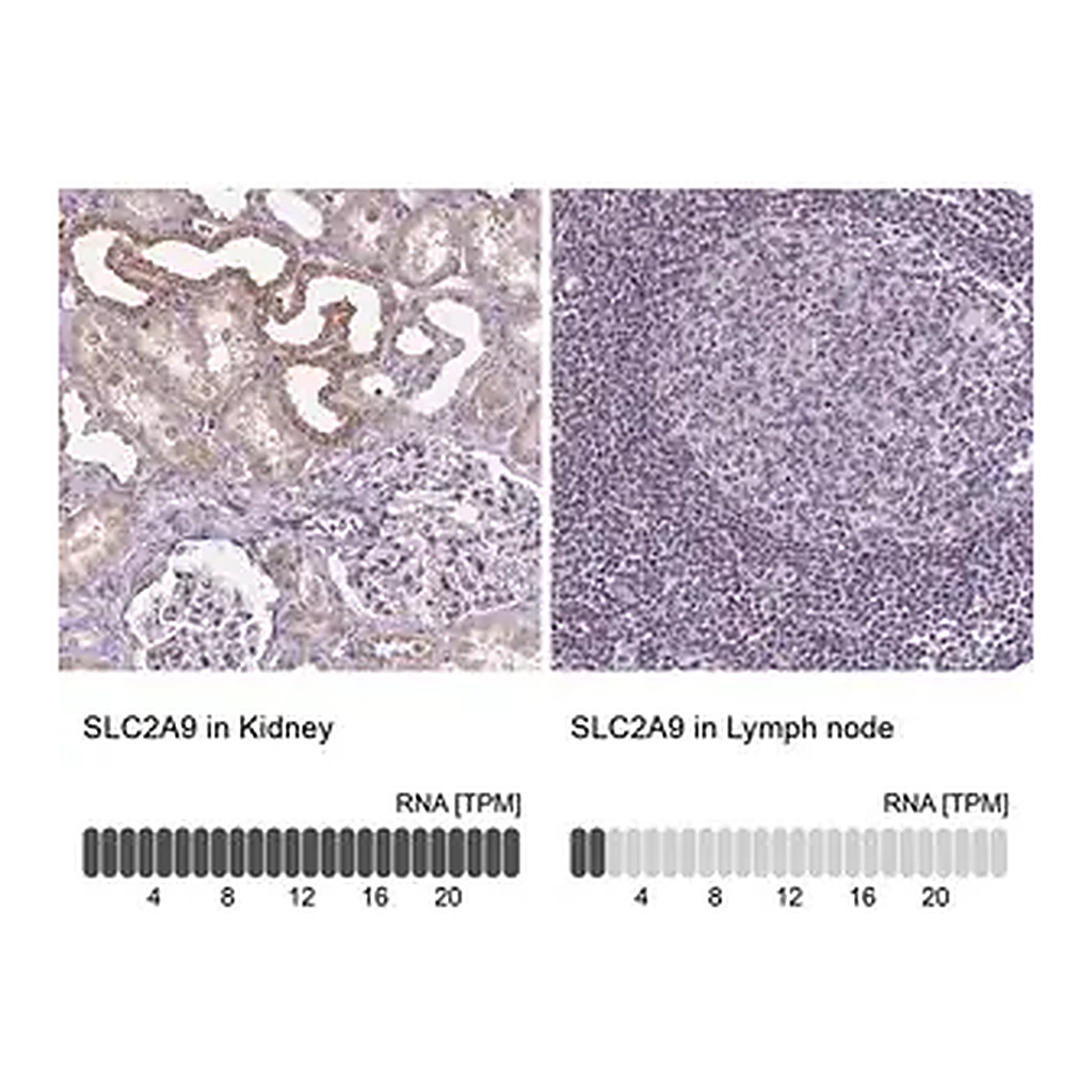 Merck Anti-SLC2A9 antibody produced in rabbit