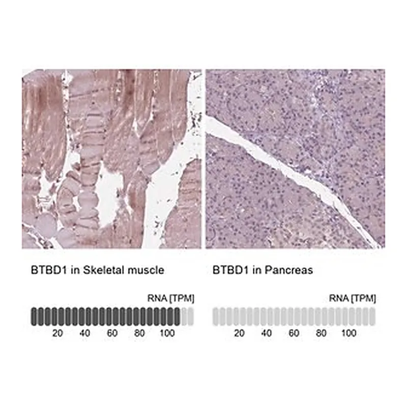 Merck Anti-BTBD1 antibody produced in rabbit