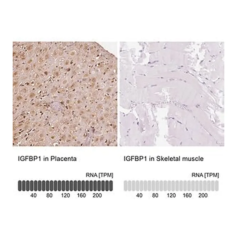 Merck Anti-IGFBP1 antibody produced in rabbit