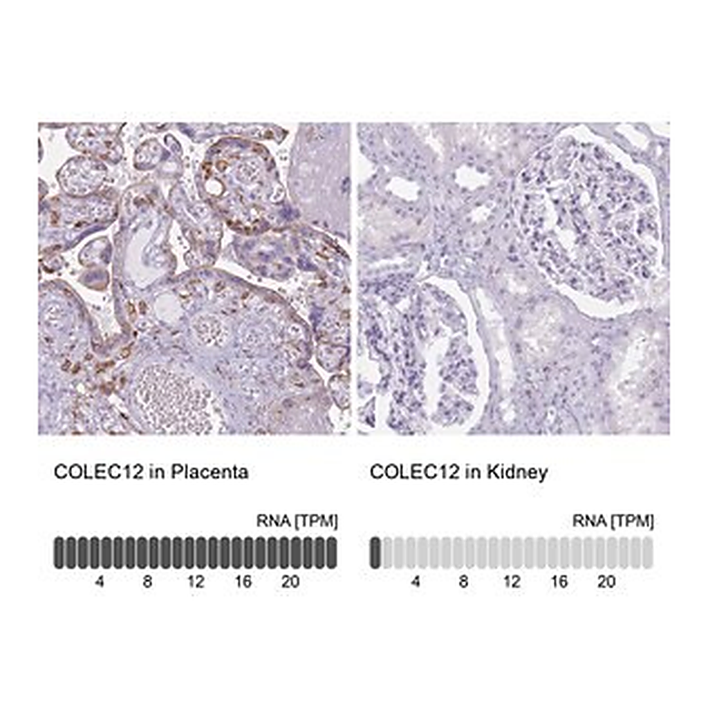 Merck Anti-COLEC12 antibody produced in rabbit