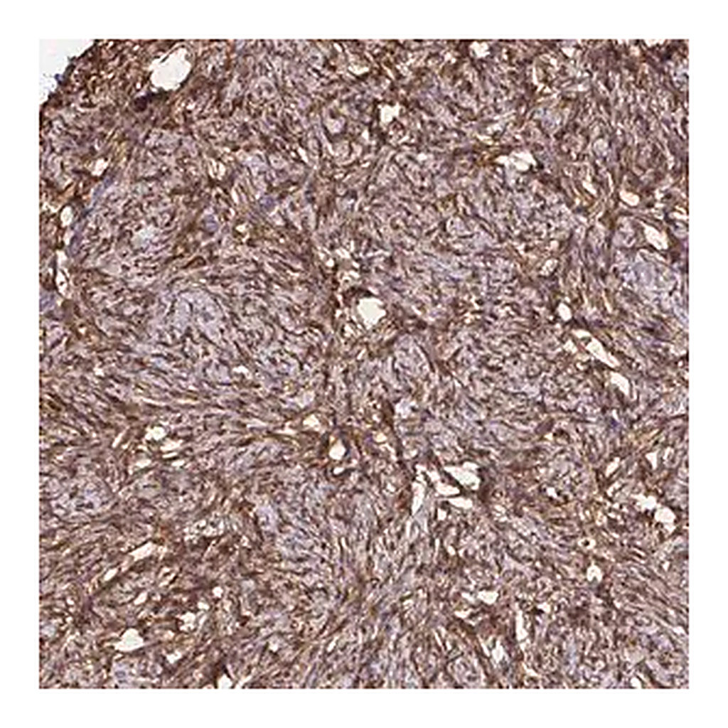 Merck Anti-RBP1 antibody produced in rabbit