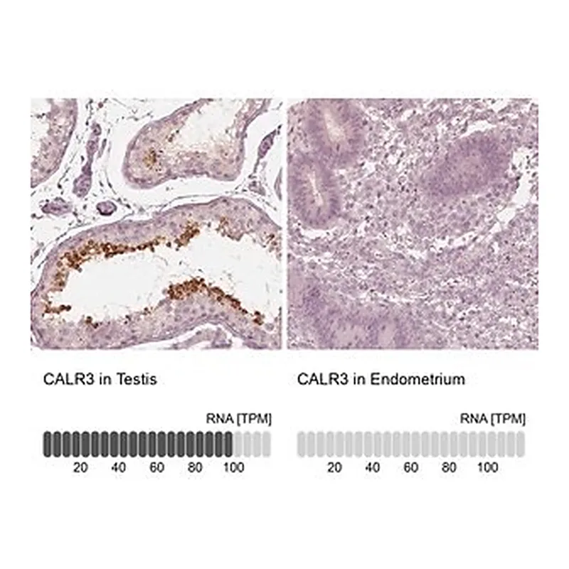 Merck Anti-CALR3 antibody produced in rabbit