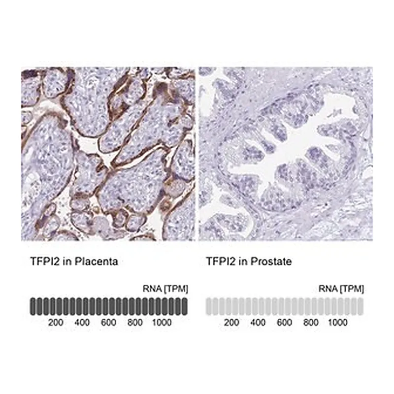 Merck Anti-TFPI2 antibody produced in rabbit