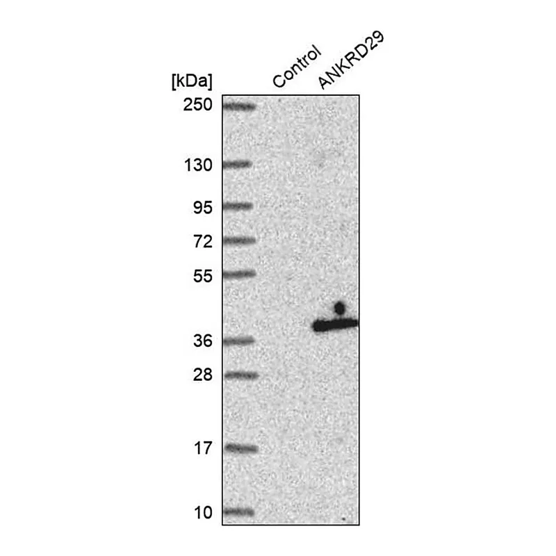 Merck Anti-ANKRD29 antibody produced in rabbit