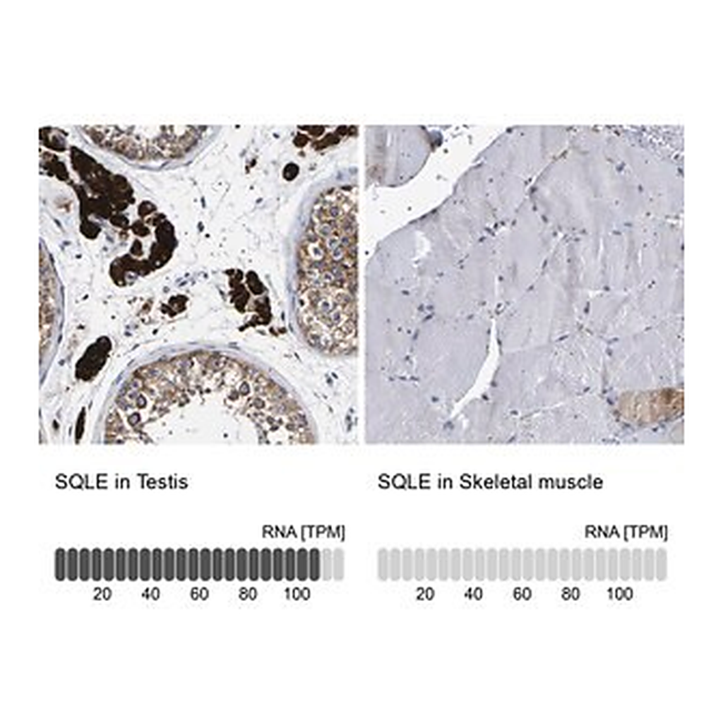 Merck Anti-SQLE antibody produced in rabbit