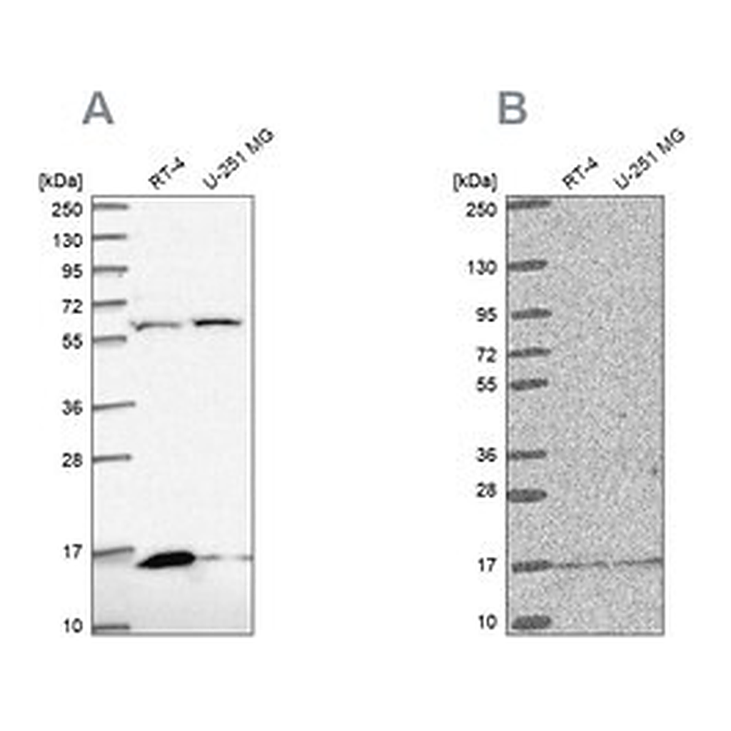 Merck Anti-MRPS16 antibody produced in rabbit