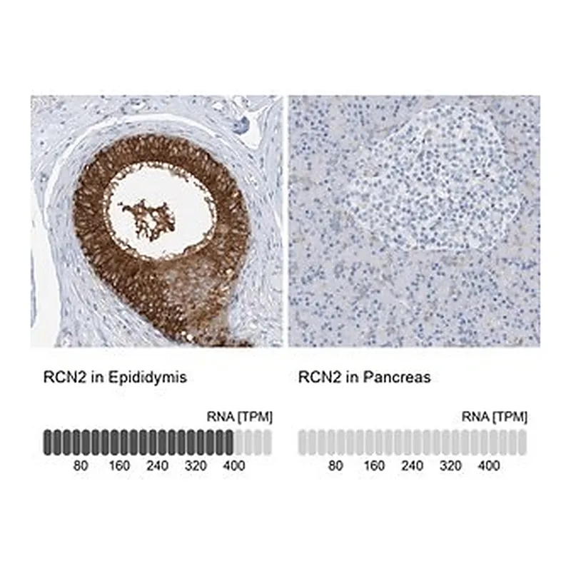 Merck Anti-RCN2 antibody produced in rabbit