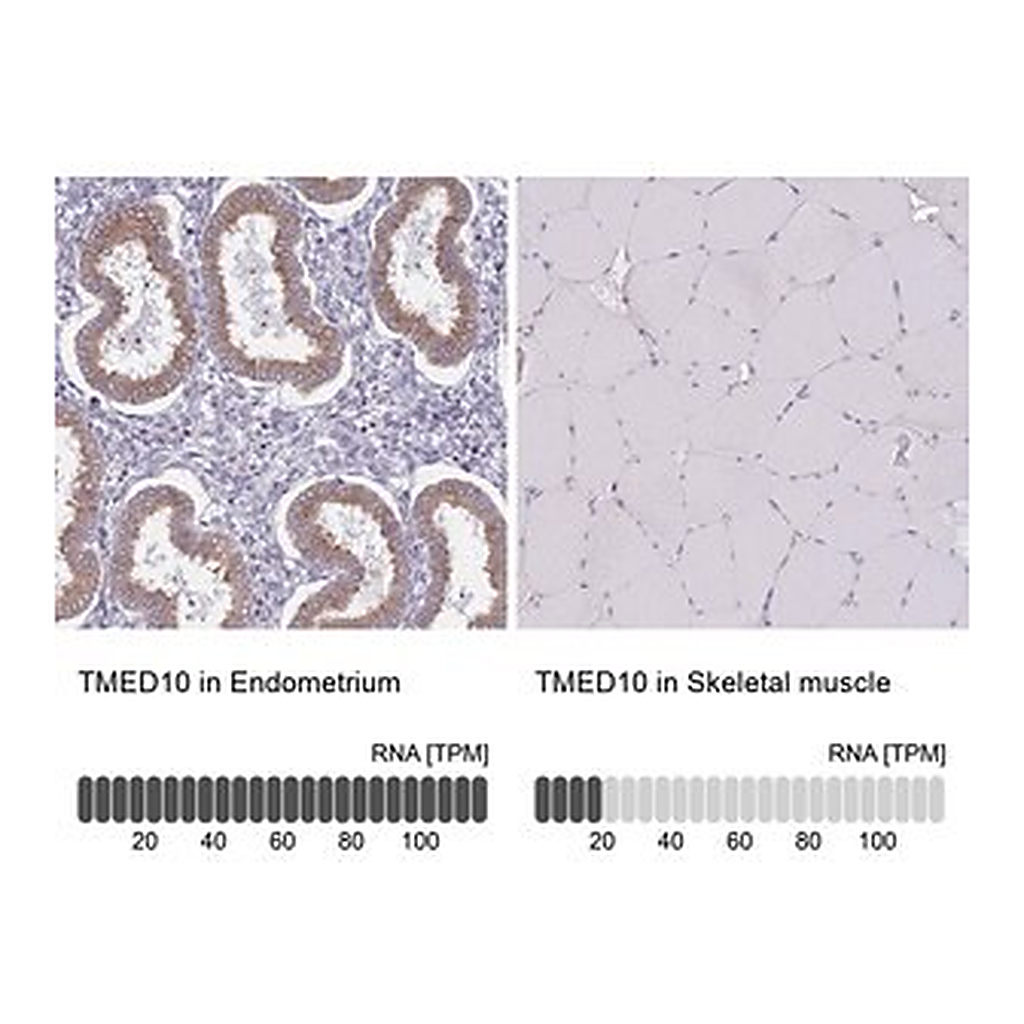 Merck Anti-TMED10 antibody produced in rabbit
