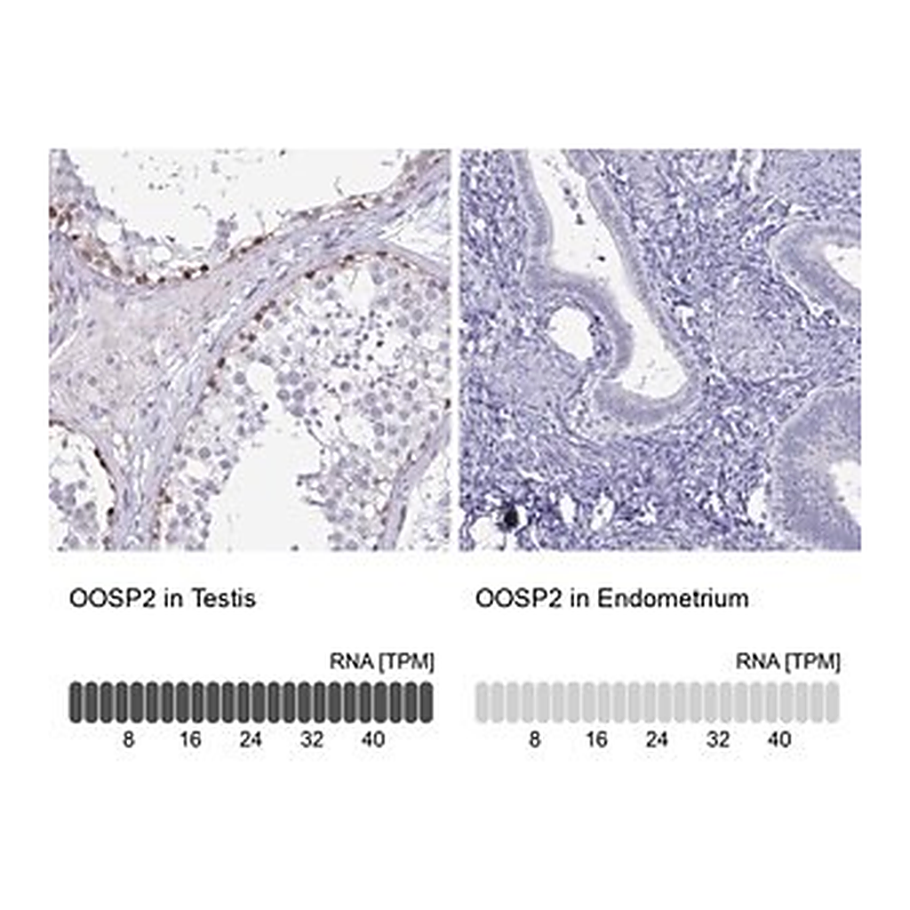 Merck Anti-OOSP2 antibody produced in rabbit