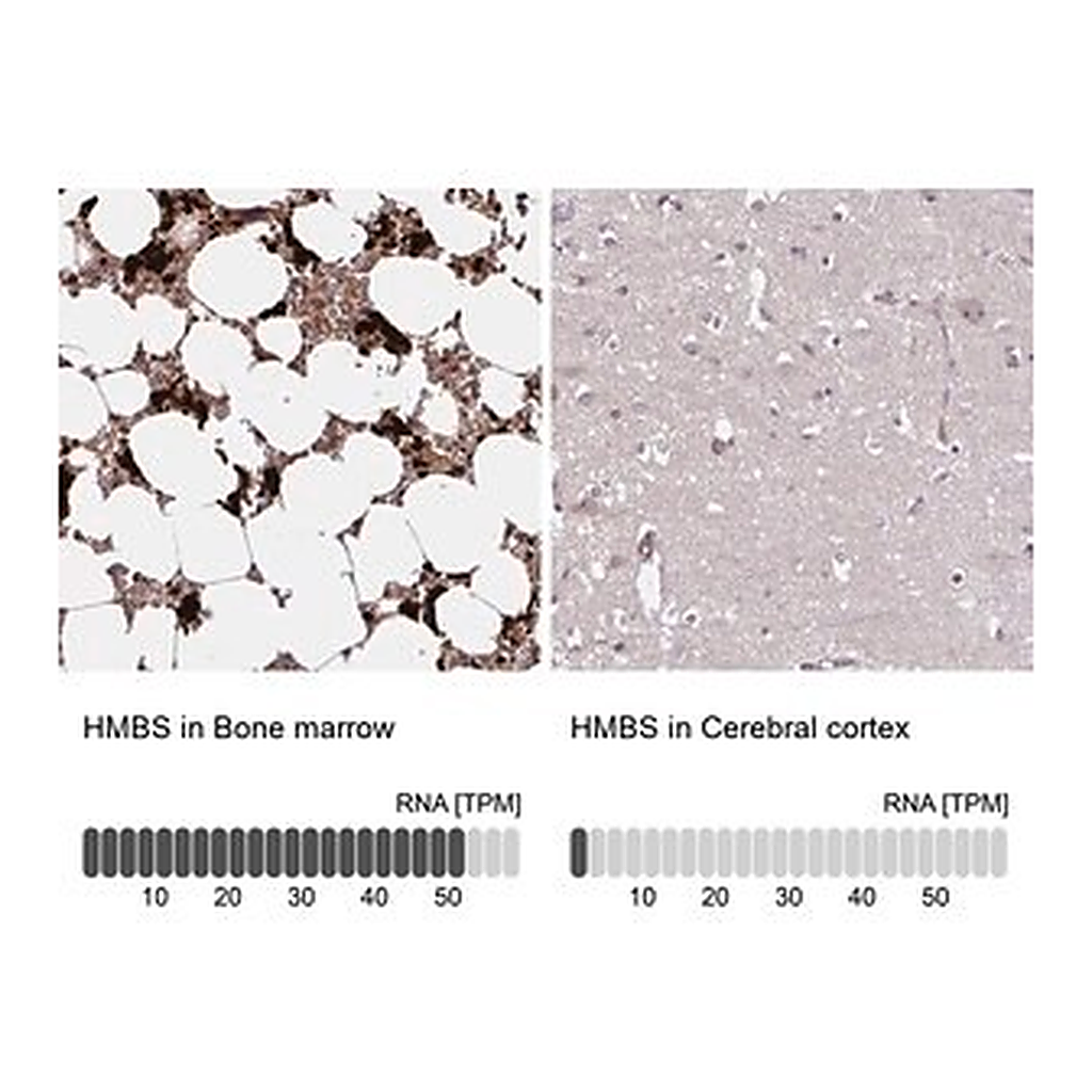 Merck Anti-HMBS antibody produced in rabbit