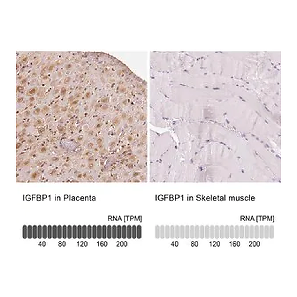 Merck Anti-IGFBP1 antibody produced in rabbit