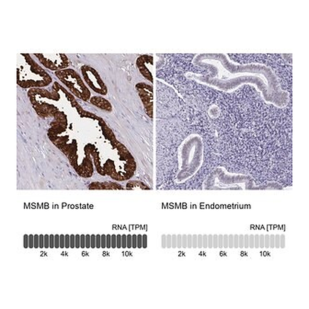 Merck Anti-MSMB antibody produced in rabbit