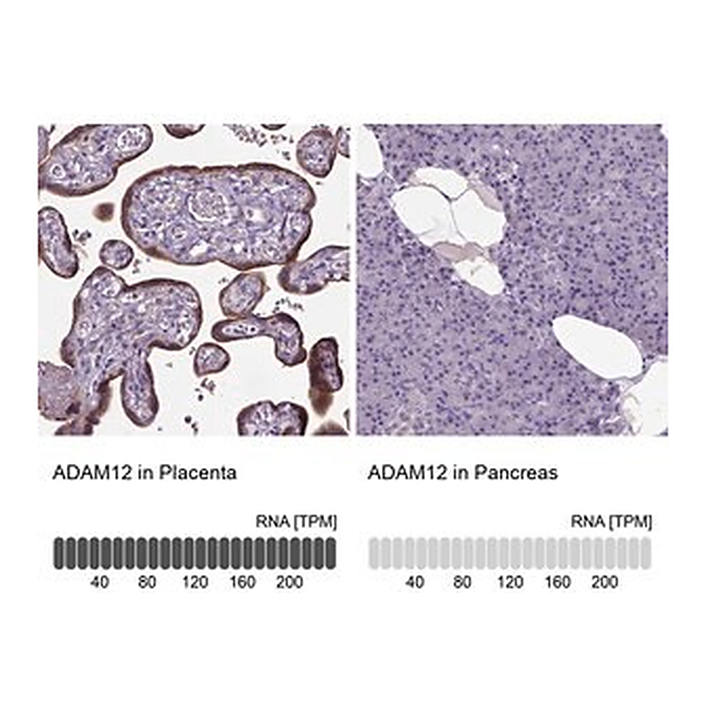 Merck Anti-ADAM12 antibody produced in rabbit