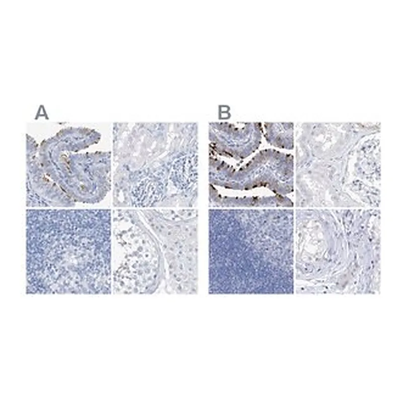 Merck Anti-C1orf87 antibody produced in rabbit