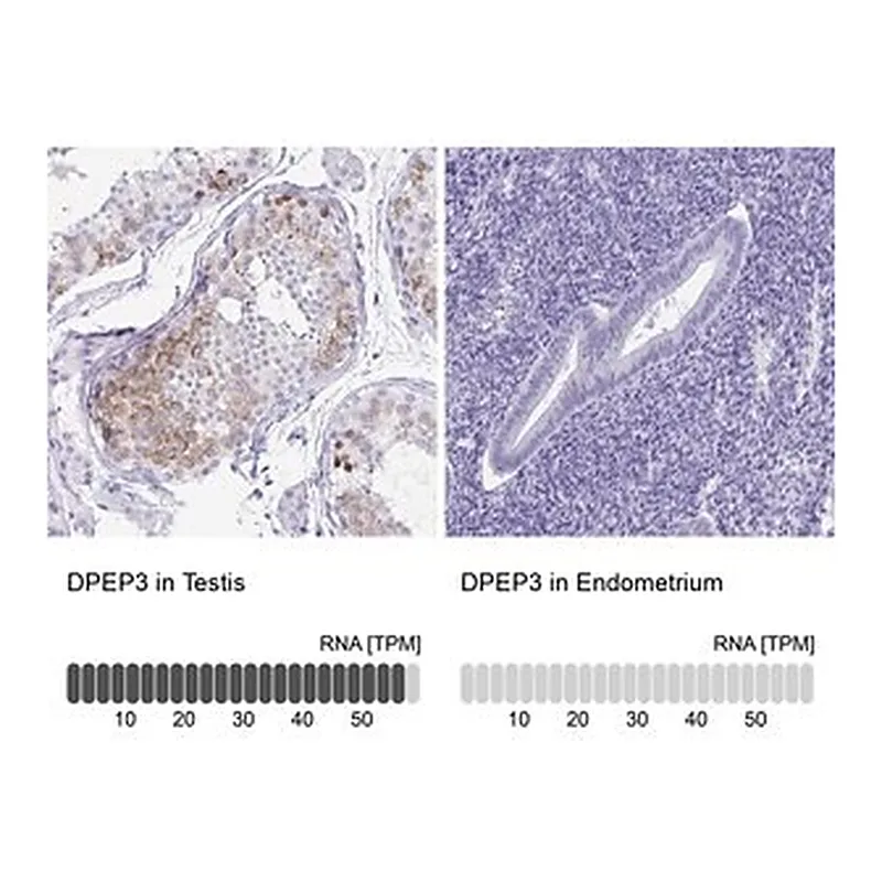 Merck Anti-DPEP3 antibody produced in rabbit