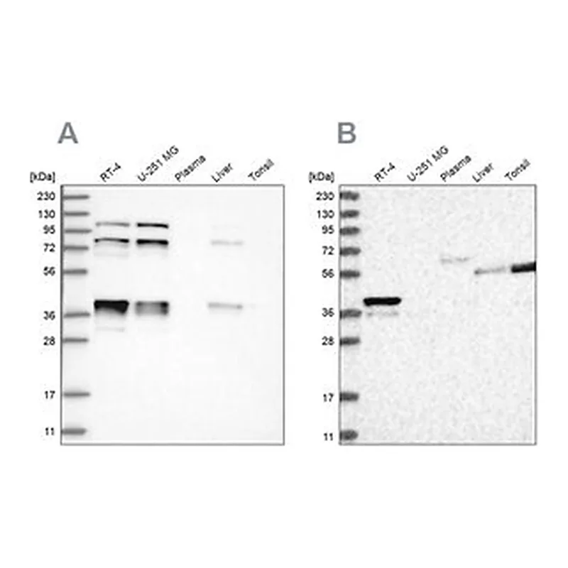Merck Anti-PLEKHA3 antibody produced in rabbit