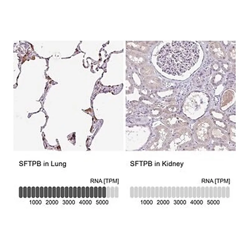 Merck Anti-SFTPB antibody produced in rabbit