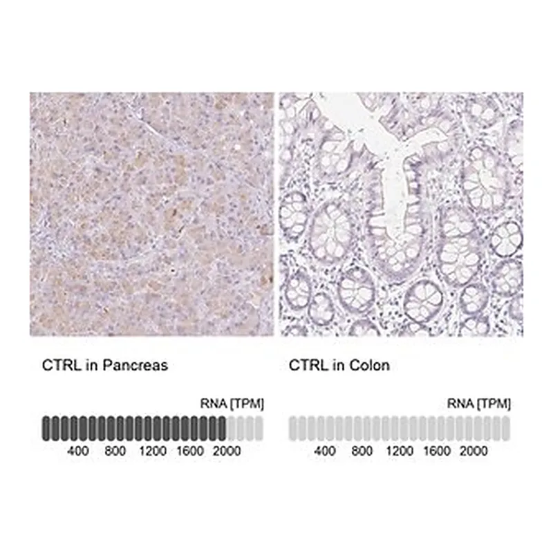 Merck Anti-CTRL antibody produced in rabbit