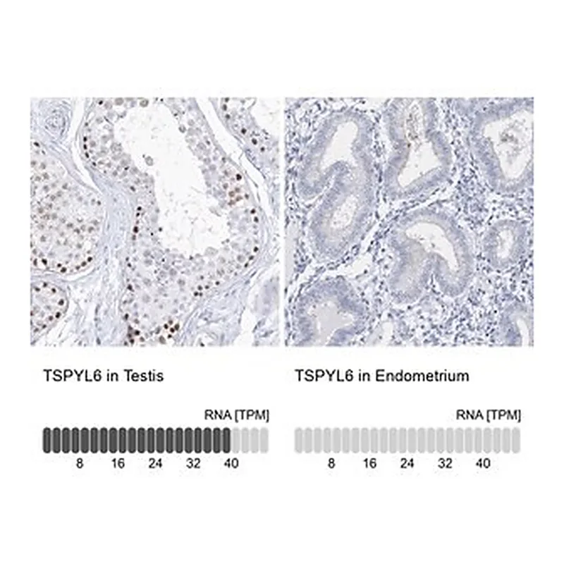 Merck Anti-TSPYL6 antibody produced in rabbit