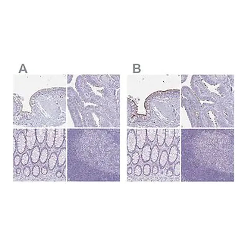 Merck Anti-CCDC39 antibody produced in rabbit