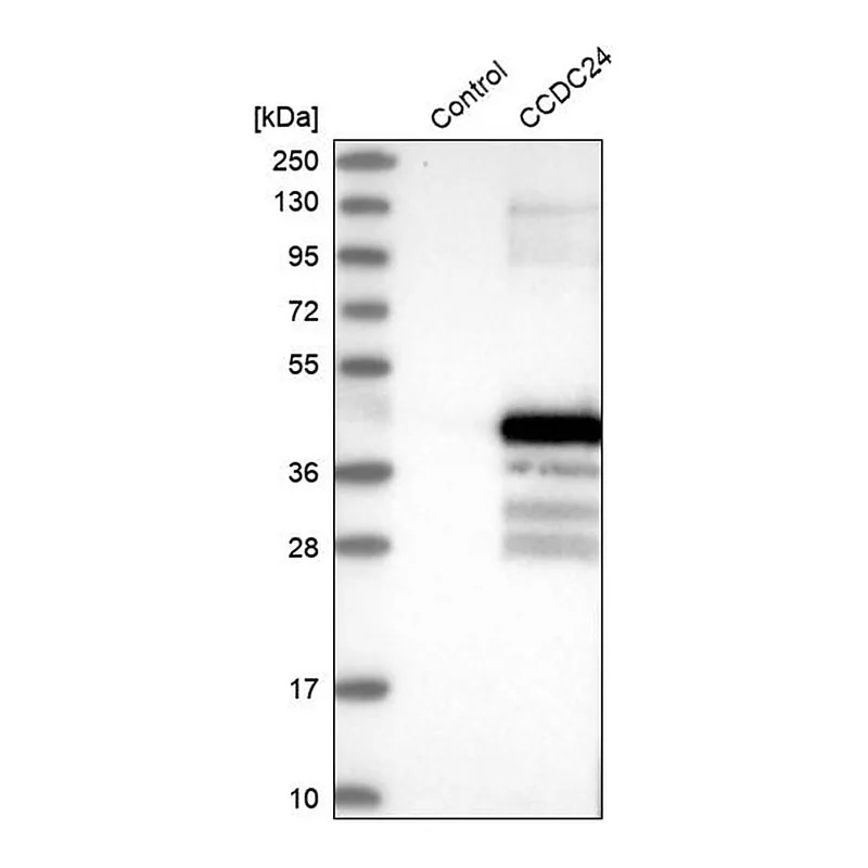Merck Anti-CCDC24 antibody produced in rabbit