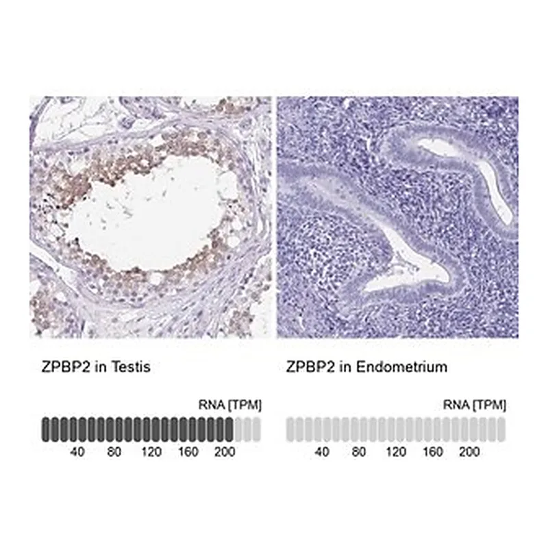 Merck Anti-ZPBP2 antibody produced in rabbit