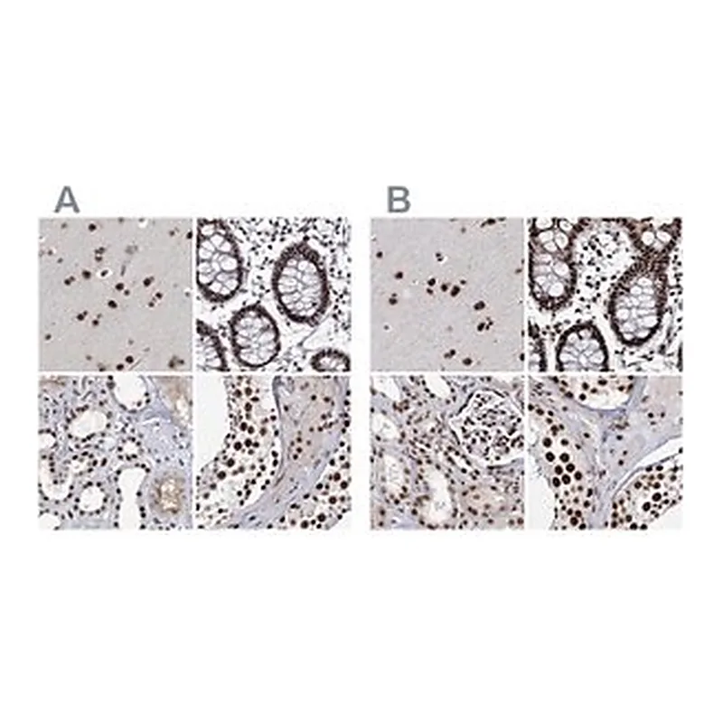 Merck Anti-SCAF8 antibody produced in rabbit