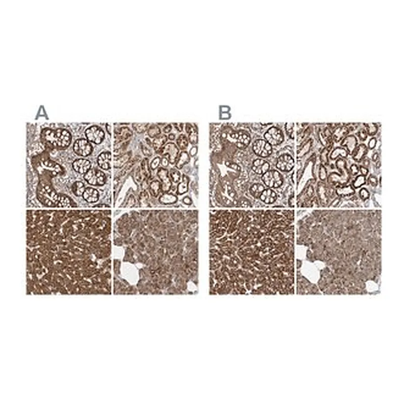 Merck Anti-MUT antibody produced in rabbit