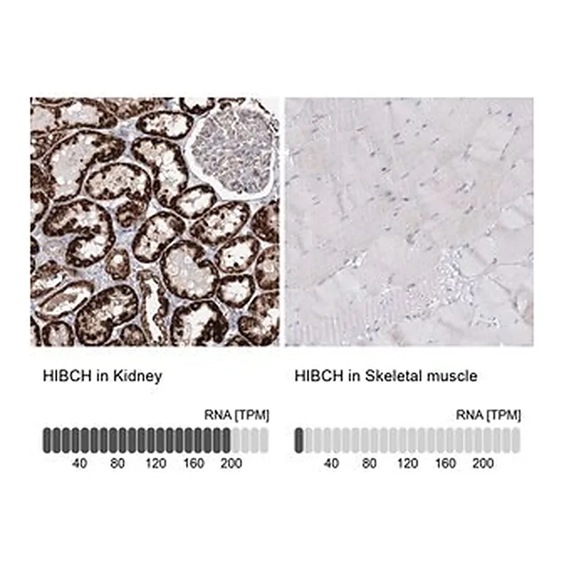 Merck Anti-HIBCH antibody produced in rabbit