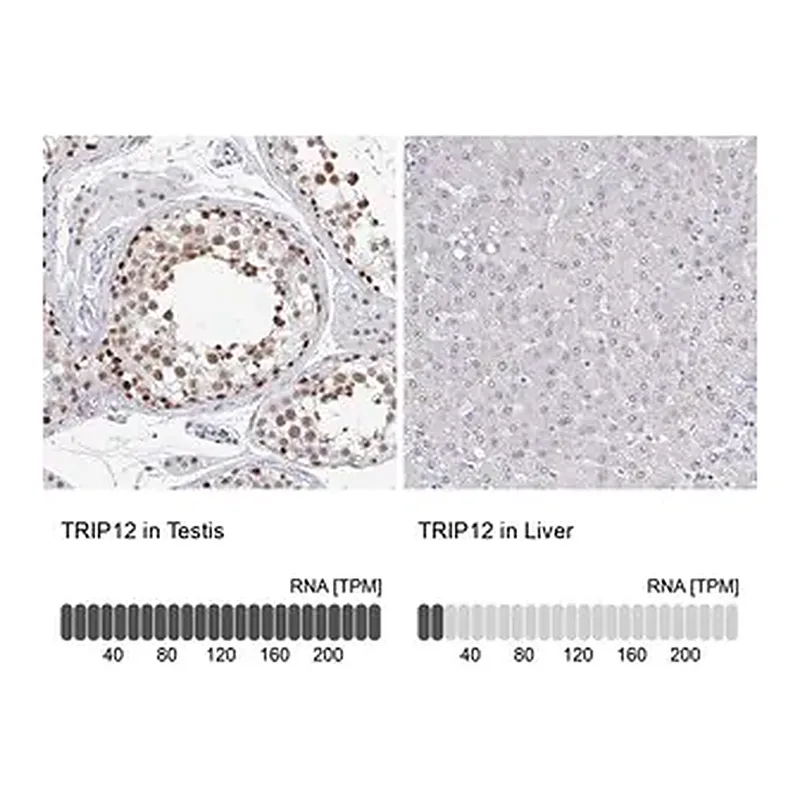 Merck Anti-TRIP12 antibody produced in rabbit