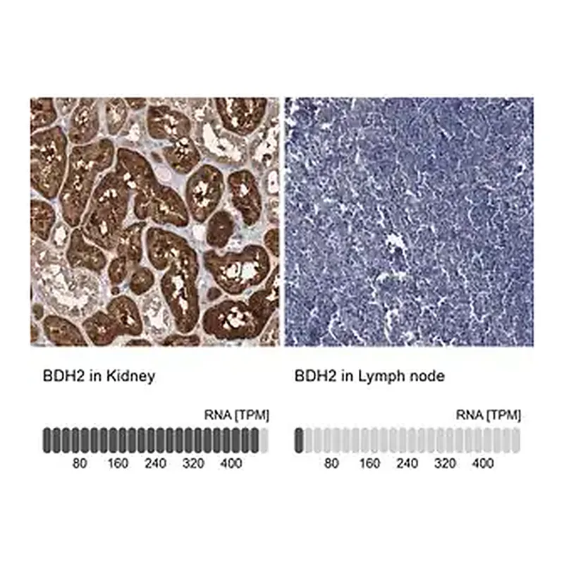 Merck Anti-BDH2 antibody produced in rabbit