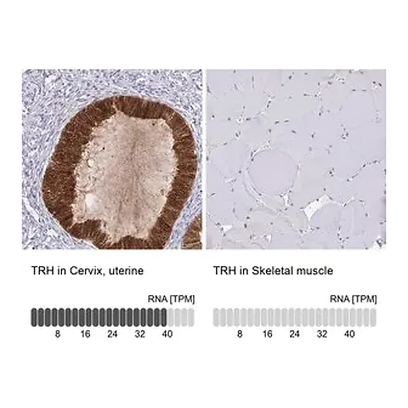 Merck Anti-TRH antibody produced in rabbit