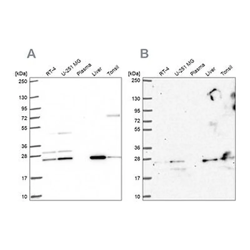 Merck Anti-CMPK1 antibody produced in rabbit
