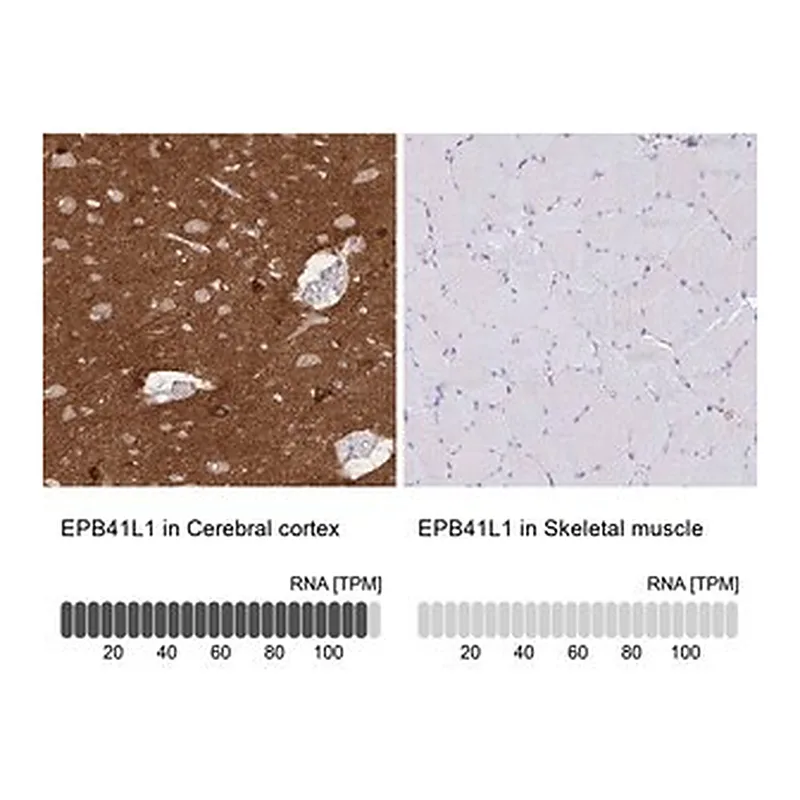 Merck Anti-EPB41L1 antibody produced in rabbit