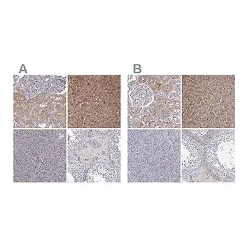 Merck Anti-GSTO1 antibody produced in rabbit